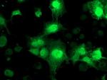 NUDT18 Antibody in Immunocytochemistry (ICC/IF)