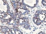 NUDT18 Antibody in Immunohistochemistry (Paraffin) (IHC (P))