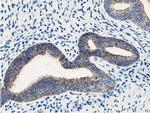 NUDT18 Antibody in Immunohistochemistry (Paraffin) (IHC (P))