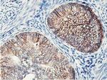 NUDT18 Antibody in Immunohistochemistry (Paraffin) (IHC (P))