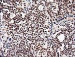 NUDT18 Antibody in Immunohistochemistry (Paraffin) (IHC (P))