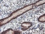 NUDT18 Antibody in Immunohistochemistry (Paraffin) (IHC (P))