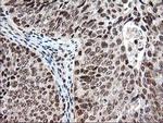 NUDT18 Antibody in Immunohistochemistry (Paraffin) (IHC (P))