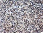 NUDT18 Antibody in Immunohistochemistry (Paraffin) (IHC (P))