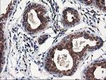 NUDT18 Antibody in Immunohistochemistry (Paraffin) (IHC (P))