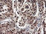 NUDT18 Antibody in Immunohistochemistry (Paraffin) (IHC (P))