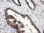 NUDT18 Antibody in Immunohistochemistry (Paraffin) (IHC (P))