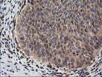 NUDT18 Antibody in Immunohistochemistry (Paraffin) (IHC (P))