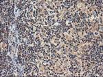 NUDT18 Antibody in Immunohistochemistry (Paraffin) (IHC (P))