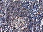 NUDT18 Antibody in Immunohistochemistry (Paraffin) (IHC (P))