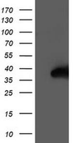 NUDT18 Antibody in Western Blot (WB)