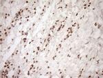 NUDT21 Antibody in Immunohistochemistry (Paraffin) (IHC (P))