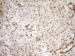 NUDT21 Antibody in Immunohistochemistry (Paraffin) (IHC (P))