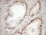 NUDT21 Antibody in Immunohistochemistry (Paraffin) (IHC (P))