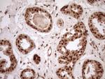 NUDT21 Antibody in Immunohistochemistry (Paraffin) (IHC (P))