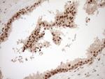 NUDT21 Antibody in Immunohistochemistry (Paraffin) (IHC (P))