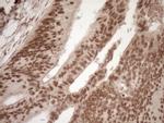 NUDT21 Antibody in Immunohistochemistry (Paraffin) (IHC (P))