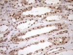 NUDT21 Antibody in Immunohistochemistry (Paraffin) (IHC (P))