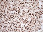 NUDT21 Antibody in Immunohistochemistry (Paraffin) (IHC (P))