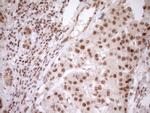 NUDT21 Antibody in Immunohistochemistry (Paraffin) (IHC (P))