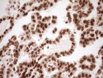 NUDT21 Antibody in Immunohistochemistry (Paraffin) (IHC (P))