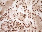 NUDT21 Antibody in Immunohistochemistry (Paraffin) (IHC (P))