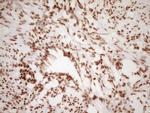 NUDT21 Antibody in Immunohistochemistry (Paraffin) (IHC (P))