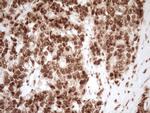 NUDT21 Antibody in Immunohistochemistry (Paraffin) (IHC (P))