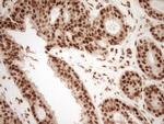 NUDT21 Antibody in Immunohistochemistry (Paraffin) (IHC (P))