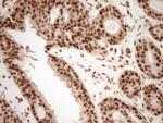 NUDT21 Antibody in Immunohistochemistry (Paraffin) (IHC (P))