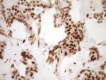 NUDT21 Antibody in Immunohistochemistry (Paraffin) (IHC (P))