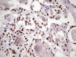 NUDT21 Antibody in Immunohistochemistry (Paraffin) (IHC (P))