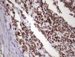 NUDT21 Antibody in Immunohistochemistry (Paraffin) (IHC (P))