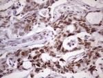 NUDT21 Antibody in Immunohistochemistry (Paraffin) (IHC (P))