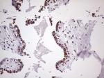 NUDT21 Antibody in Immunohistochemistry (Paraffin) (IHC (P))