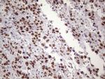 NUDT21 Antibody in Immunohistochemistry (Paraffin) (IHC (P))