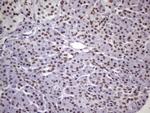 NUDT21 Antibody in Immunohistochemistry (Paraffin) (IHC (P))