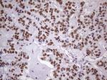 NUDT21 Antibody in Immunohistochemistry (Paraffin) (IHC (P))