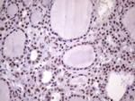 NUDT21 Antibody in Immunohistochemistry (Paraffin) (IHC (P))