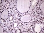 NUDT21 Antibody in Immunohistochemistry (Paraffin) (IHC (P))