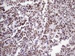 NUDT21 Antibody in Immunohistochemistry (Paraffin) (IHC (P))
