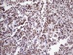 NUDT21 Antibody in Immunohistochemistry (Paraffin) (IHC (P))