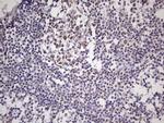 NUDT21 Antibody in Immunohistochemistry (Paraffin) (IHC (P))