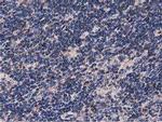 NUDT6 Antibody in Immunohistochemistry (Paraffin) (IHC (P))