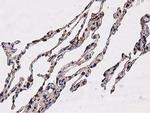 NUDT6 Antibody in Immunohistochemistry (Paraffin) (IHC (P))