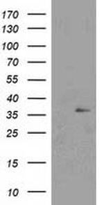 NUDT6 Antibody in Western Blot (WB)