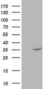 NUDT6 Antibody in Western Blot (WB)