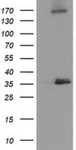 NUDT6 Antibody in Western Blot (WB)