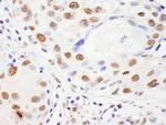 NUMA Antibody in Immunohistochemistry (IHC)