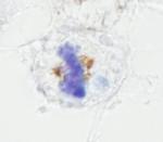 NUMA Antibody in Immunohistochemistry (IHC)